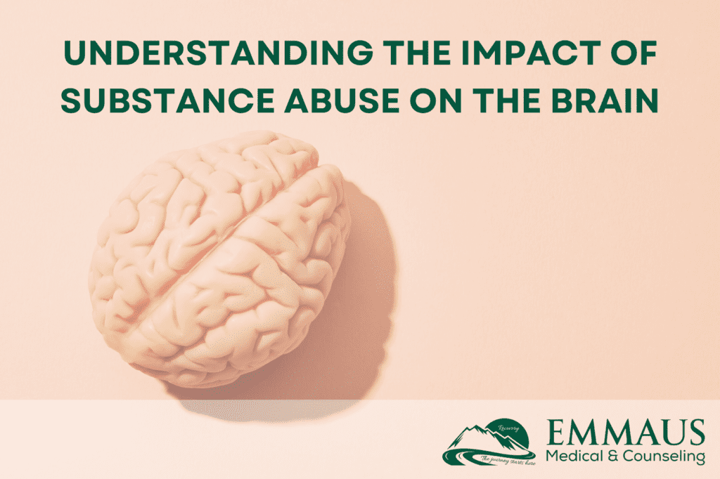 Understanding the Impact of Substance Abuse on the Brain